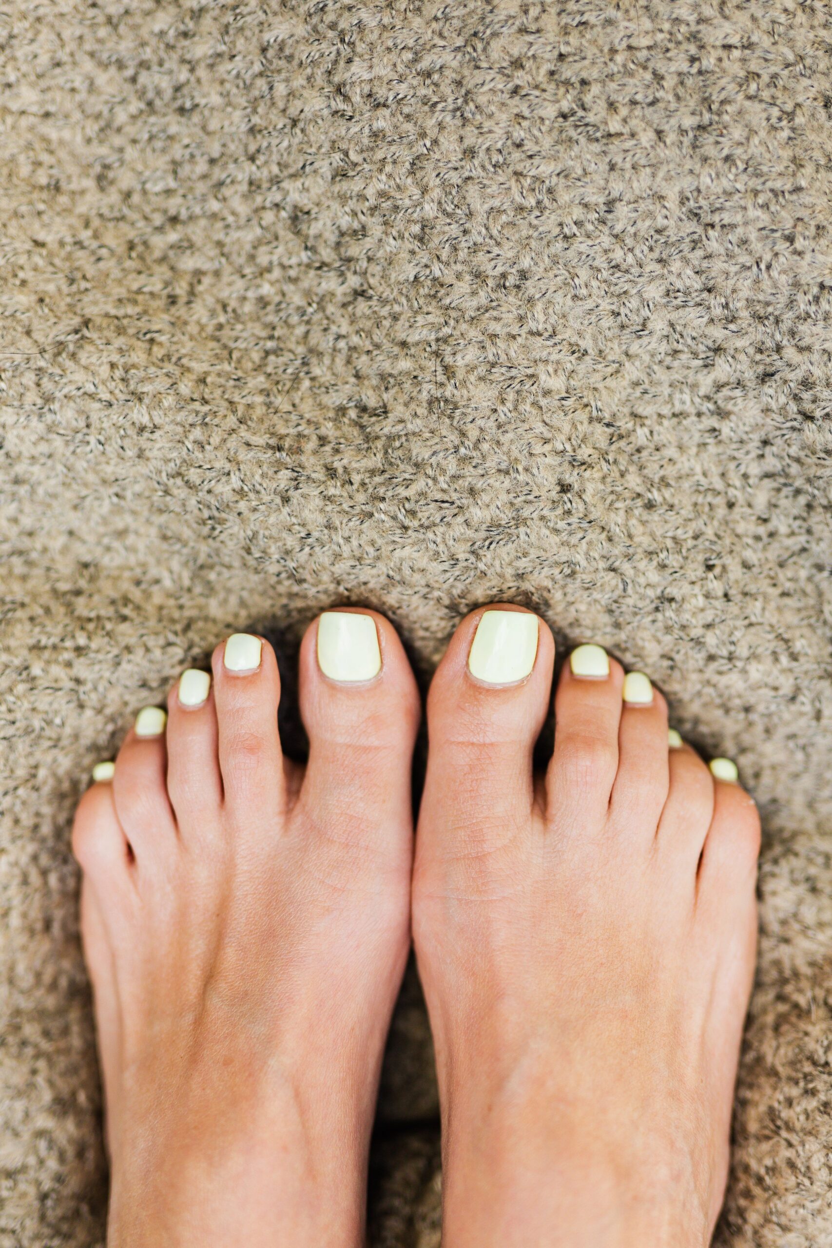 What Does Nail Fungus Look Like? Stage-by-Stage Guide